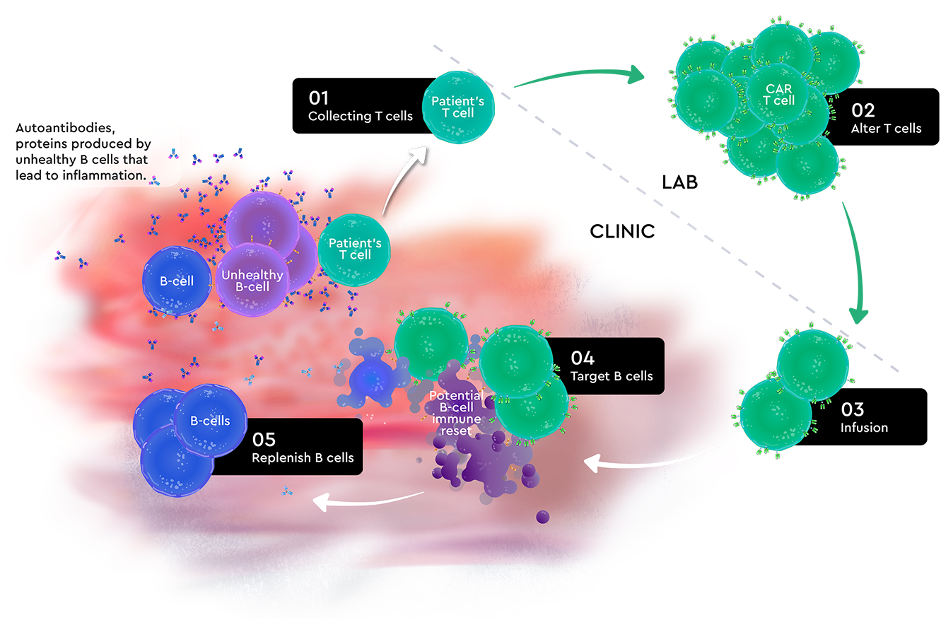 CAR T-Cell therapy process
